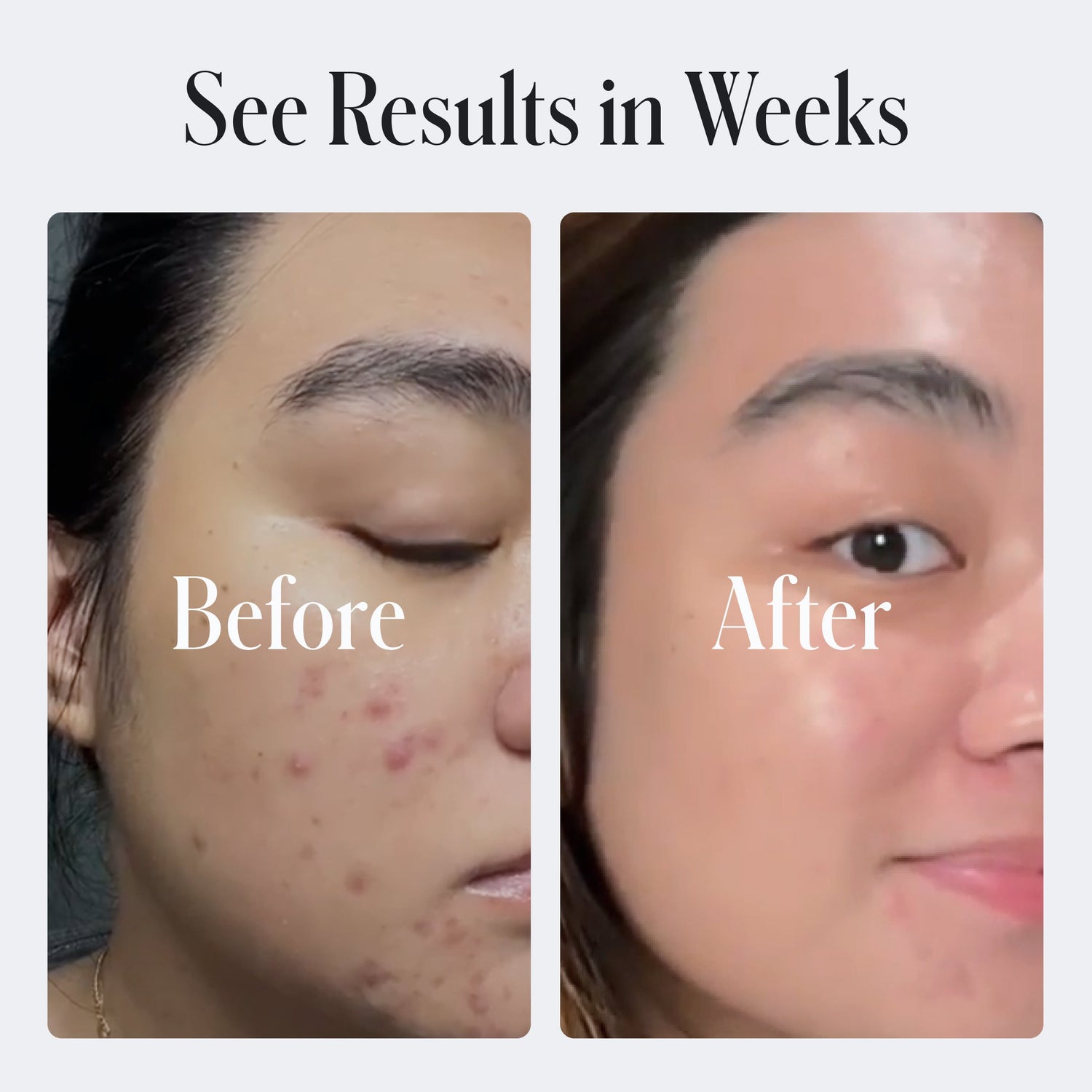 Clear Skin Face Cream by Geologie
