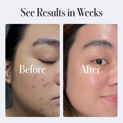 Clear Skin Face Cream by Geologie