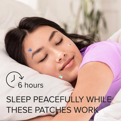 Pimple &amp; Acne Patches by Maree