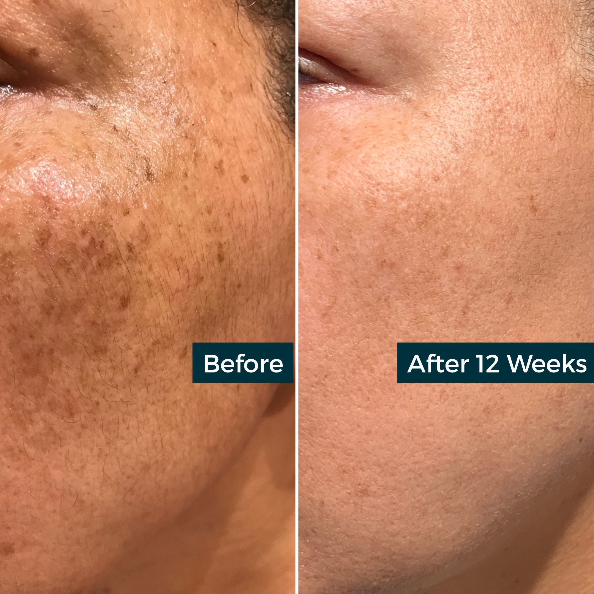 Retinol Plus Vitamin C Skin Refining Night Oil by AbsoluteJOI® Skincare