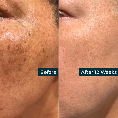 Retinol Plus Vitamin C Skin Refining Night Oil by AbsoluteJOI® Skincare