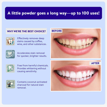 Activated Charcoal Teeth Whitening Powder by Active Wow