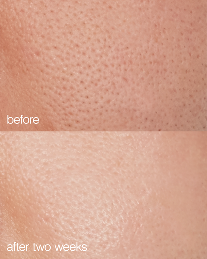 Biome Boost Cream Daily Moisturizer by LAPCOS