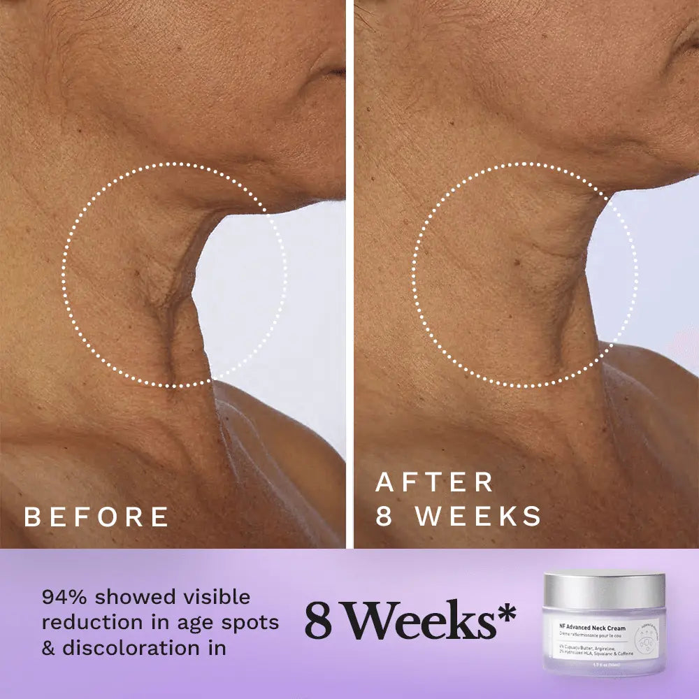 NF Advanced Neck Cream by Clearly Basics