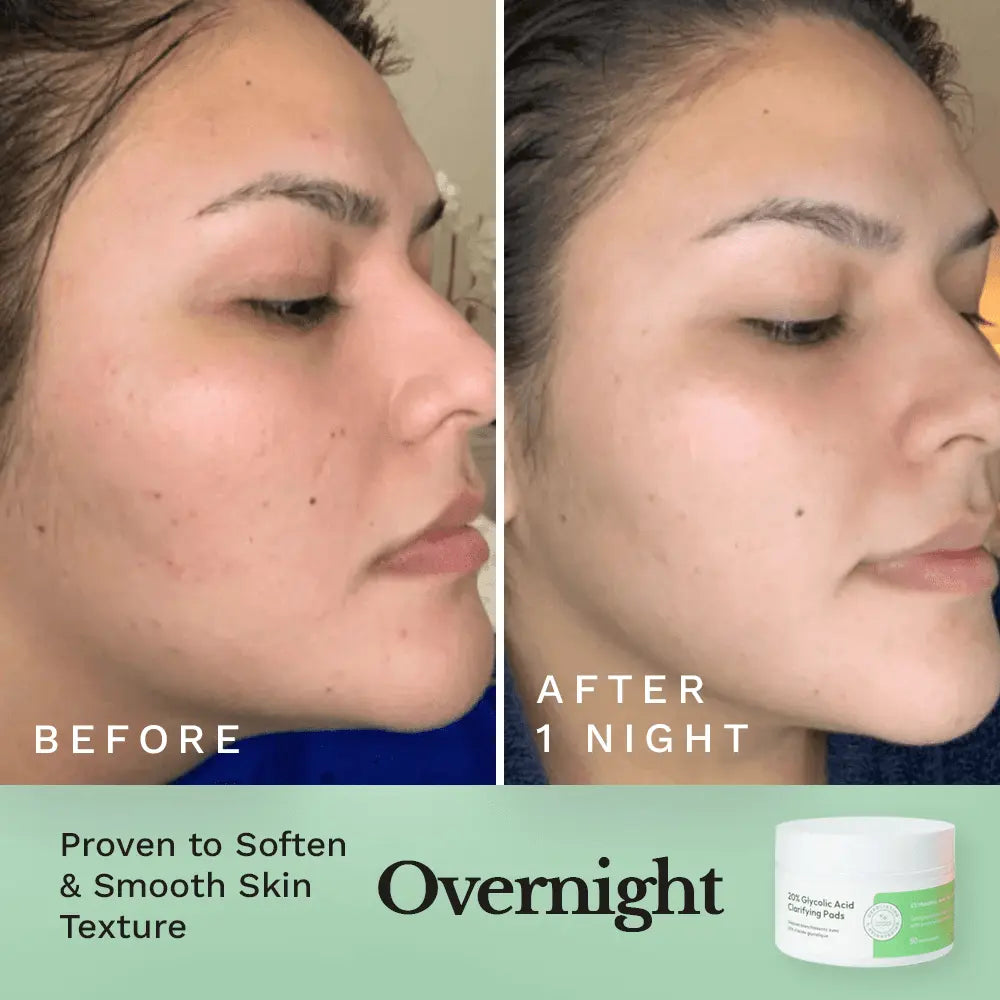 Glycolic Resurfacing Peel Pads by Clearly Basics
