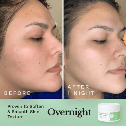Glycolic Resurfacing Peel Pads by Clearly Basics
