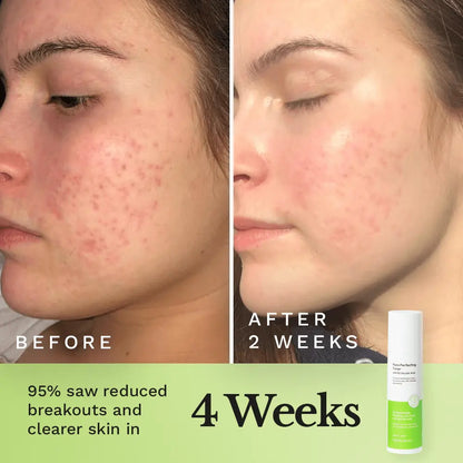 Pore Perfecting Toner by Clearly Basics