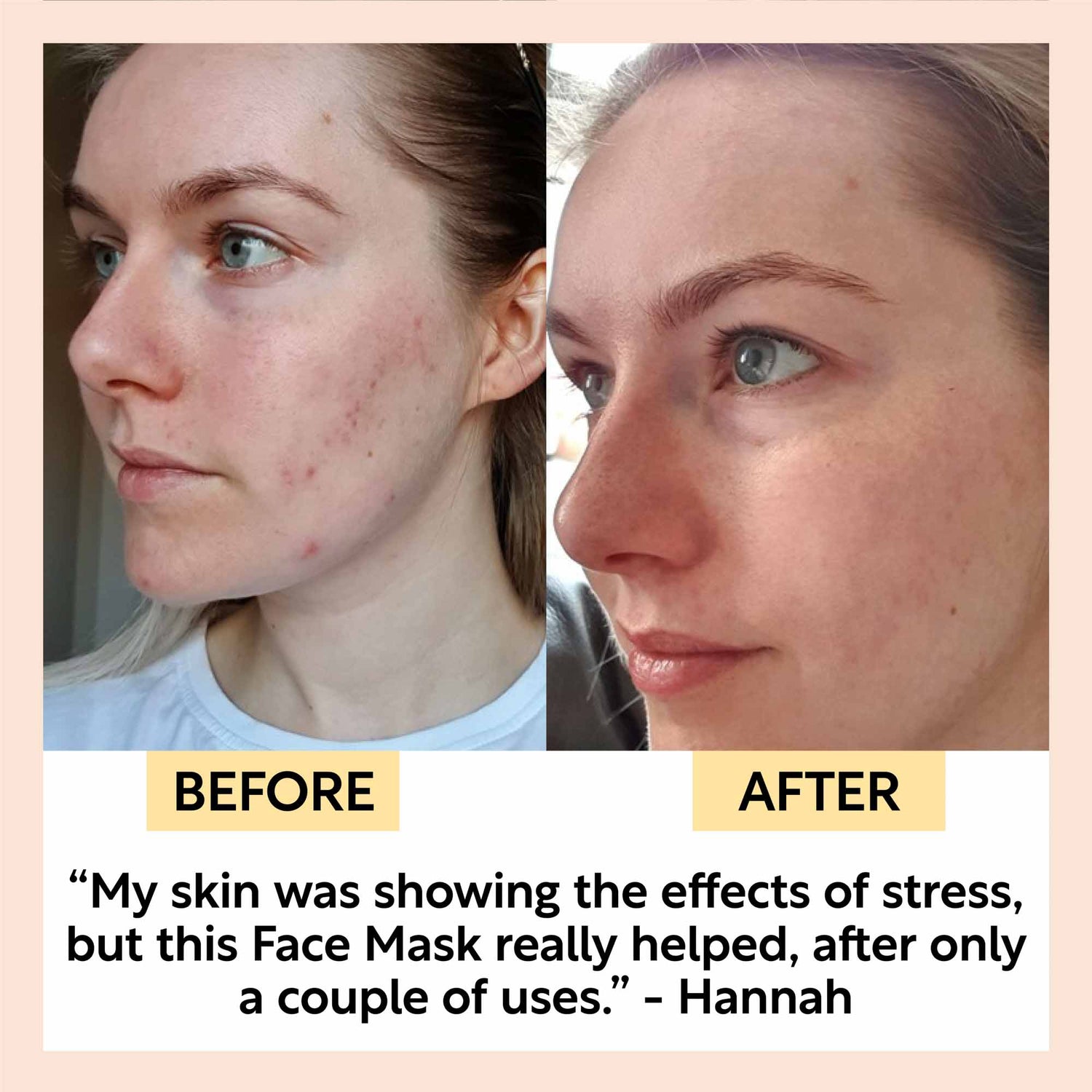 Kaolin Clay Face Mask by UpCircle
