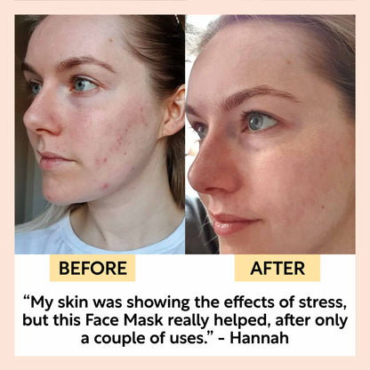 Kaolin Clay Face Mask by UpCircle