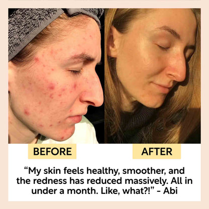 Kaolin Clay Face Mask by UpCircle