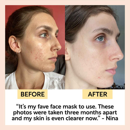 Kaolin Clay Face Mask by UpCircle