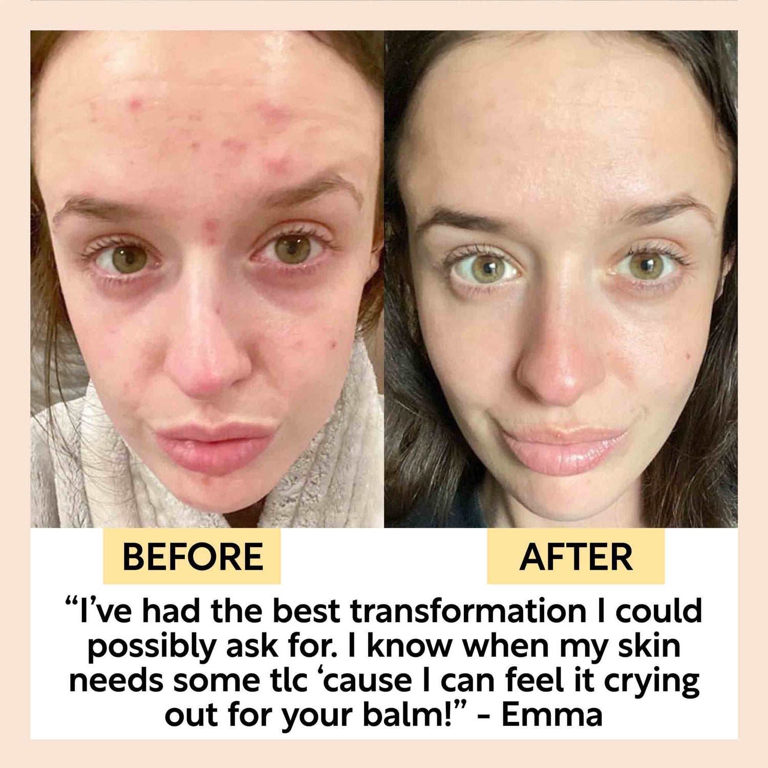Cleansing Face Balm with Oat Oil + Vitamin E by UpCircle
