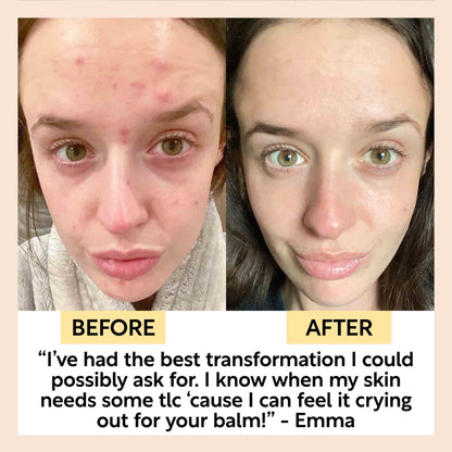 Cleansing Face Balm with Oat Oil + Vitamin E by UpCircle