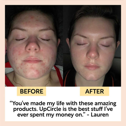 Double Cleansing Duo by UpCircle
