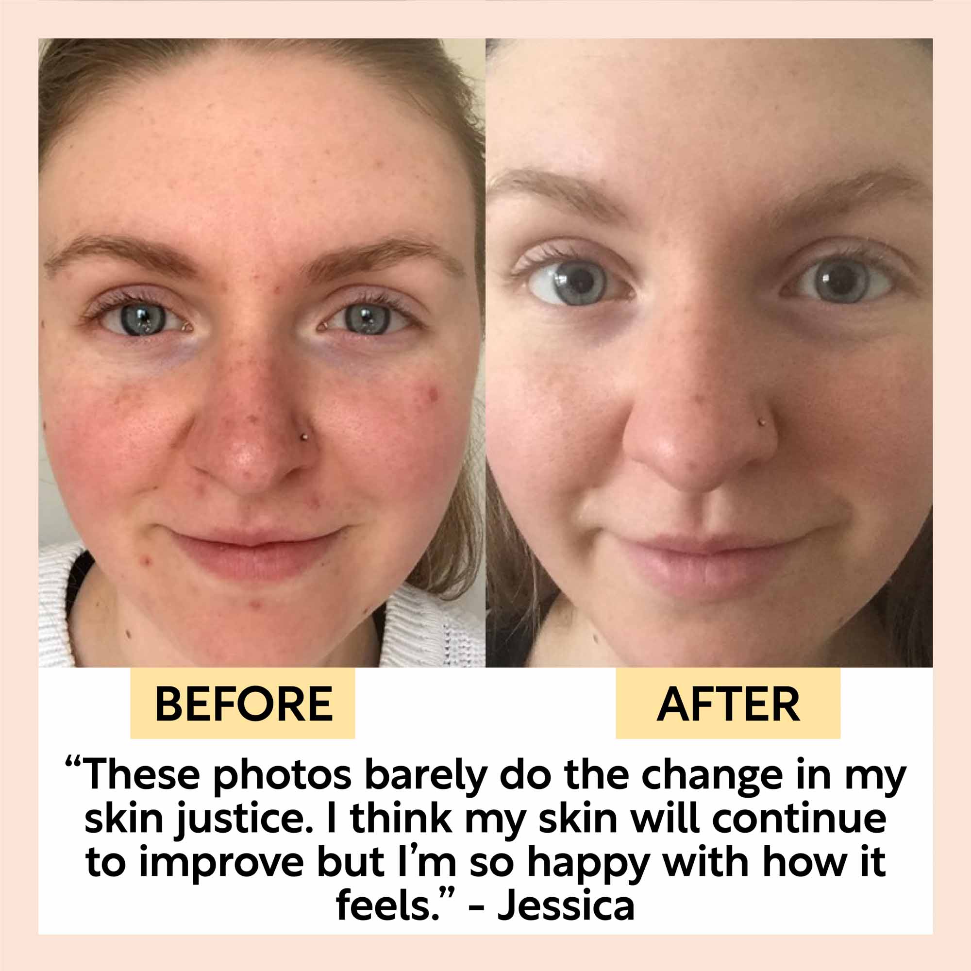 Travel-Size Skincare Bundle by UpCircle
