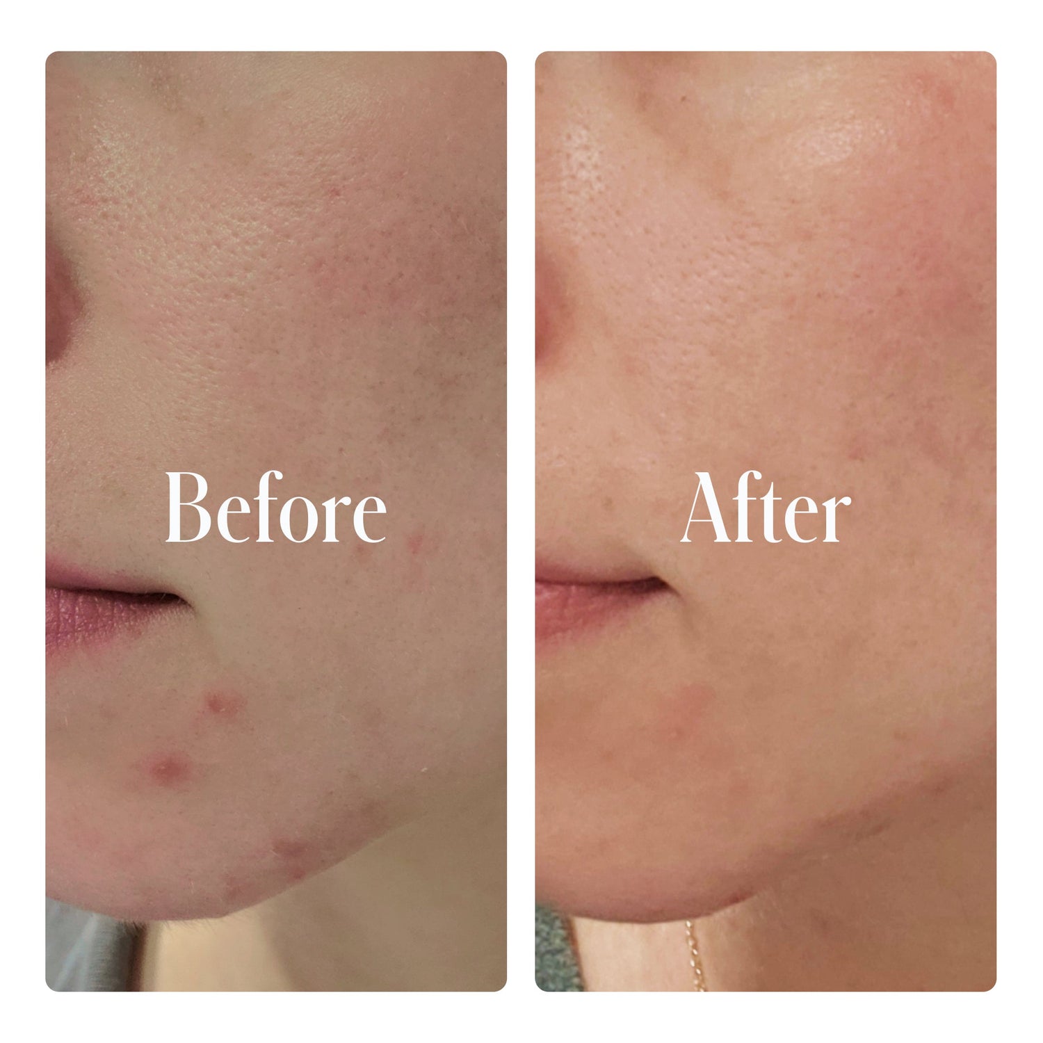 Clear System Full Routine by Geologie
