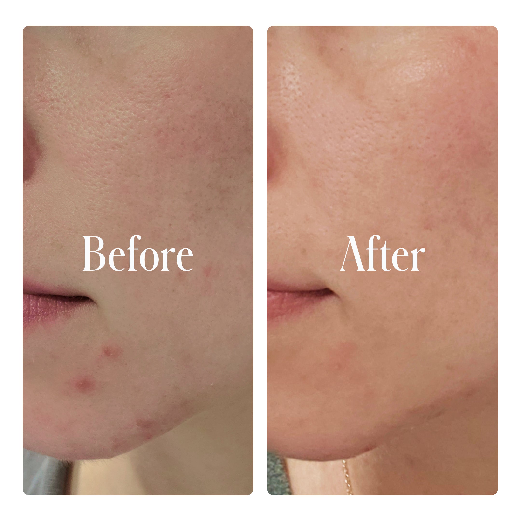 Clear System Face Routine by Geologie