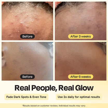 Advanced Brightening Moisturizer by Gleamin