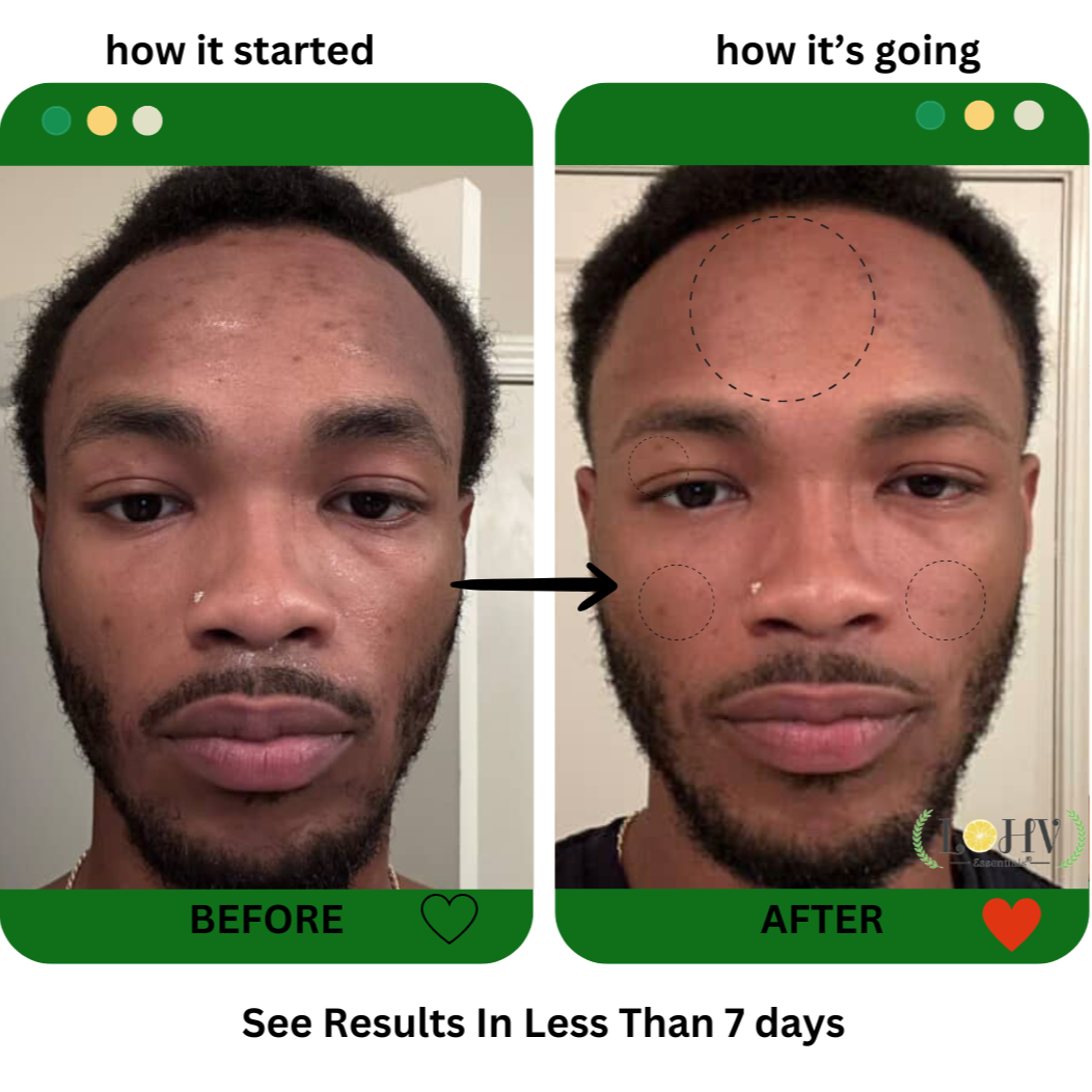 PREMIUM 100% VEGAN GLOW UP Toner Serum With Hyaluronic Acid + Niacinamide + Camellia Leaf + Vitamin E + Rose Water by LOHV ESSENTIALS
