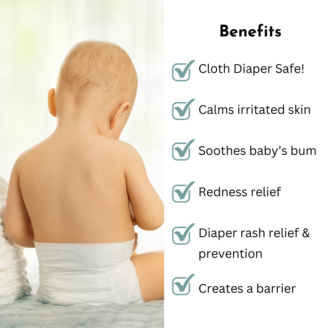 Baby Diaper Rash Relief Balm by Irene Organics