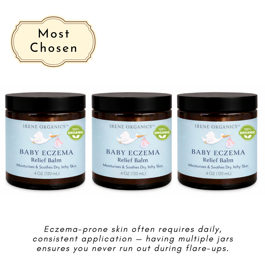 Baby Eczema Relief Balm by Irene Organics