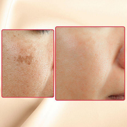 The Eraser Spot Cream | Dark Spot Corrector by gymsegbë