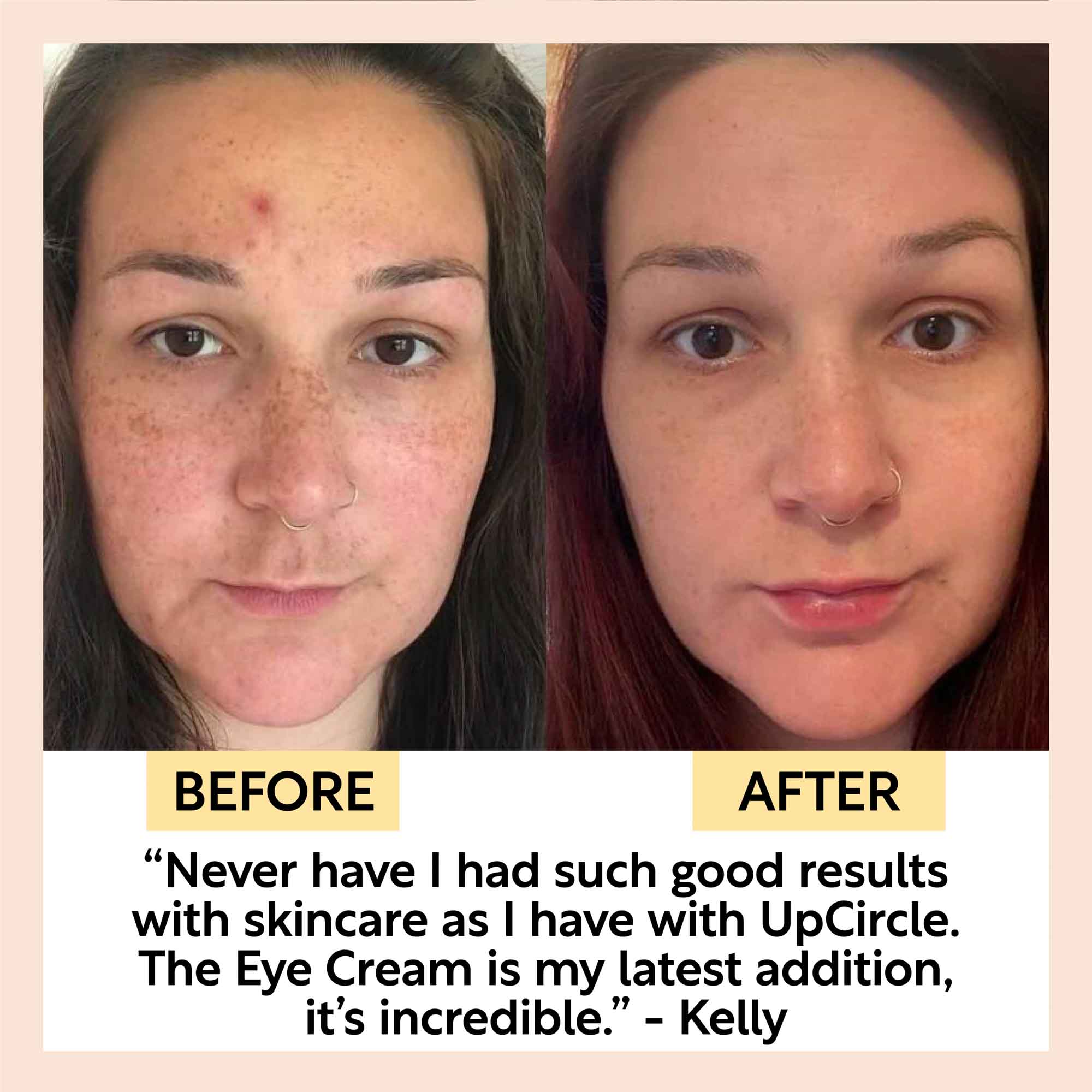 Eye Cream with Hyaluronic Acid &amp; Coffee by UpCircle