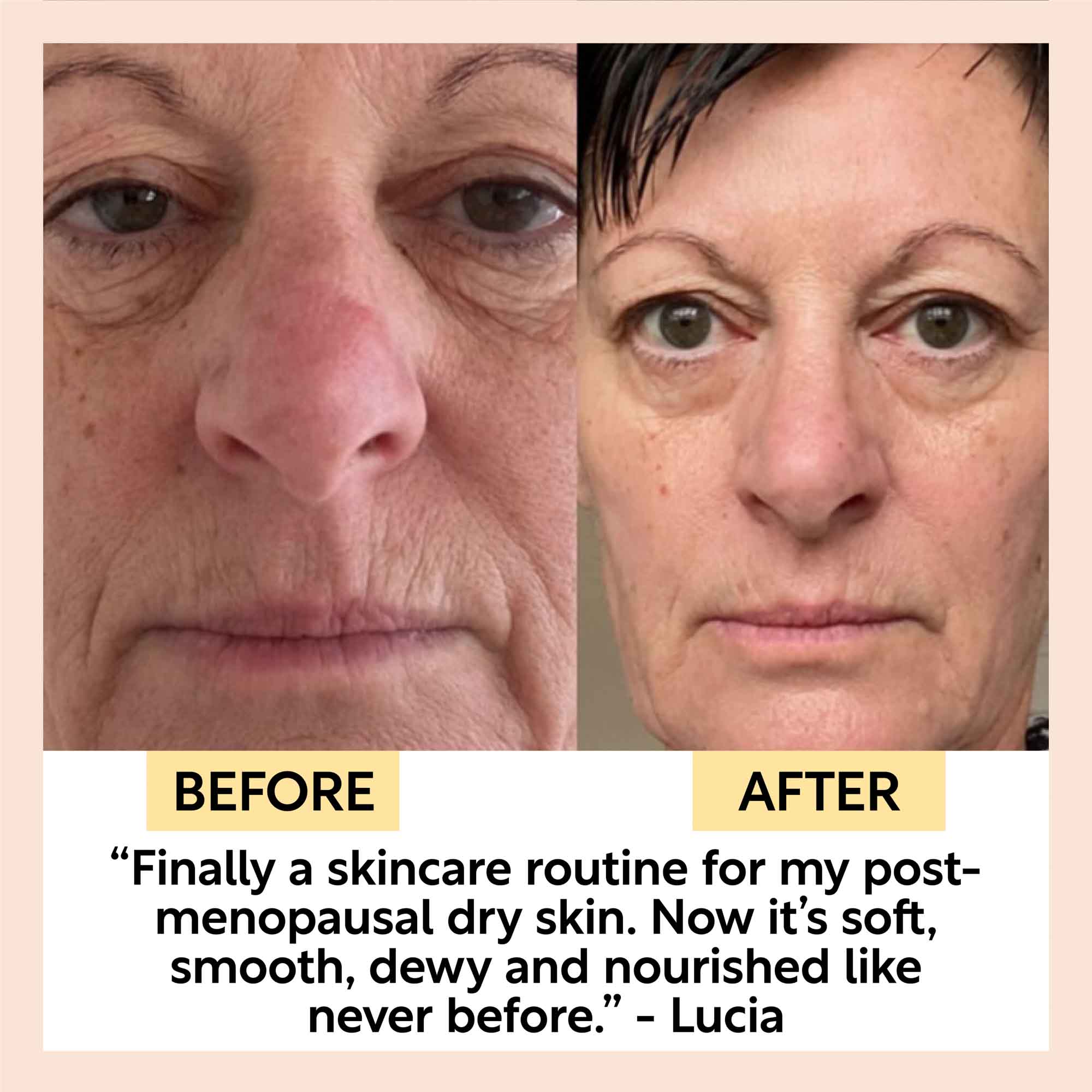 Anti-Aging Skincare Bundle by UpCircle