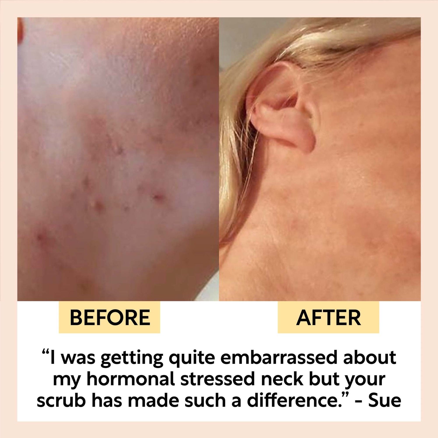 Face Scrub with Coffee + Rosehip Oil by UpCircle