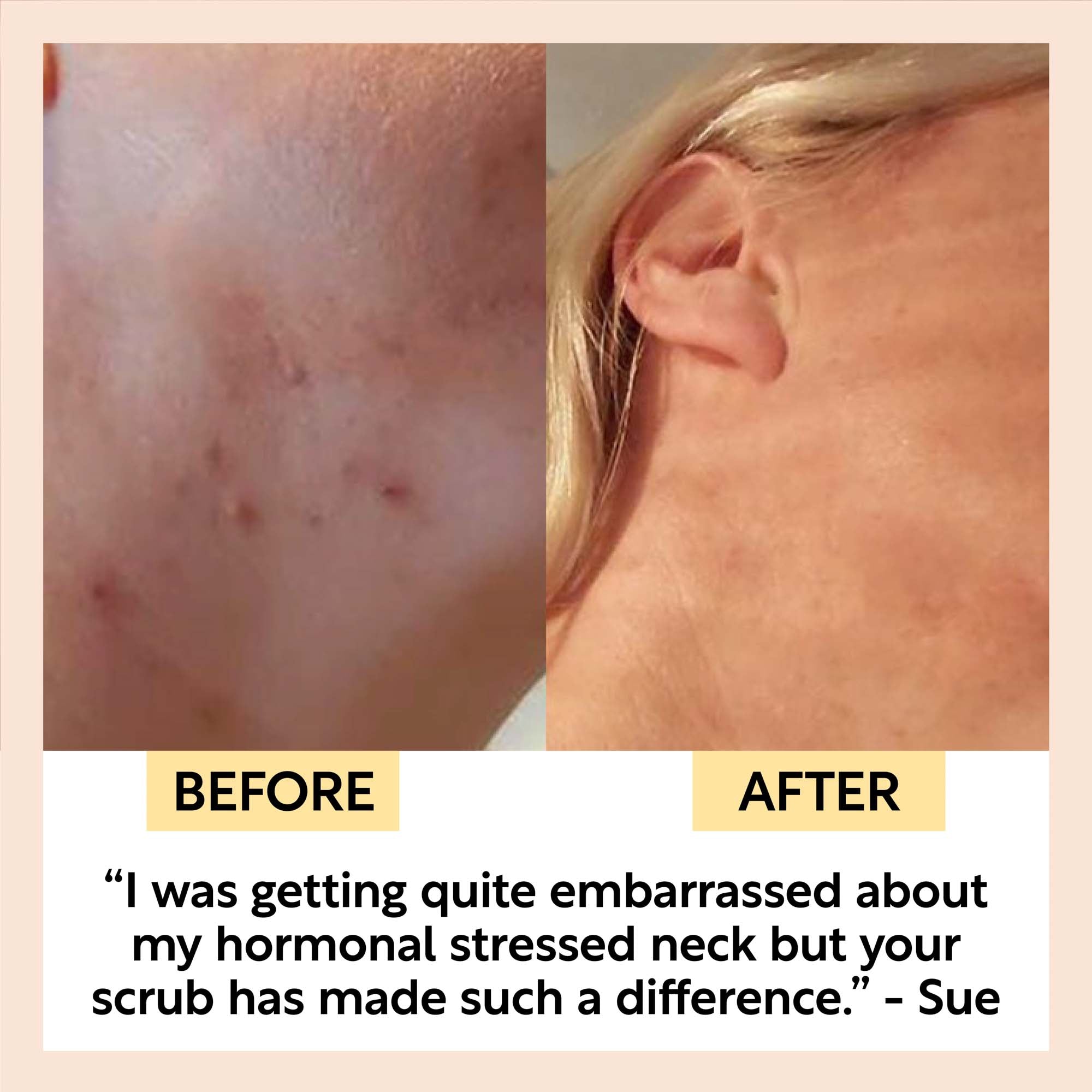 Face Scrub with Coffee + Rosehip Oil by UpCircle