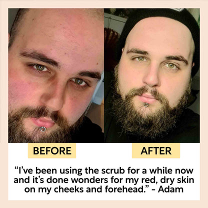 Face Scrub with Coffee + Rosehip Oil by UpCircle
