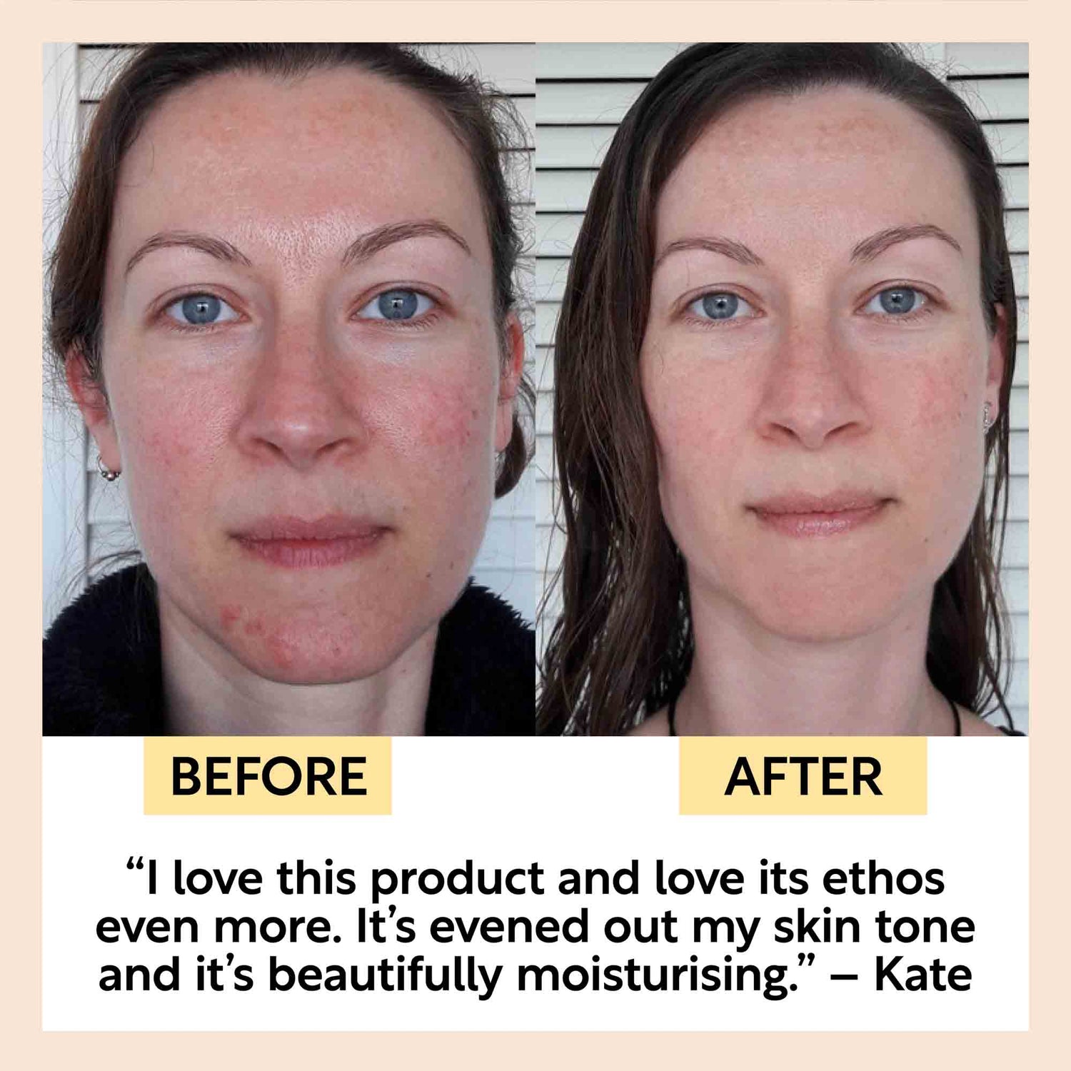 Anti-Aging Skincare Bundle by UpCircle