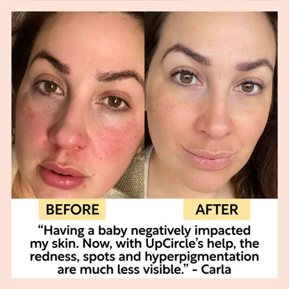 Day + Night Hydration Set by UpCircle