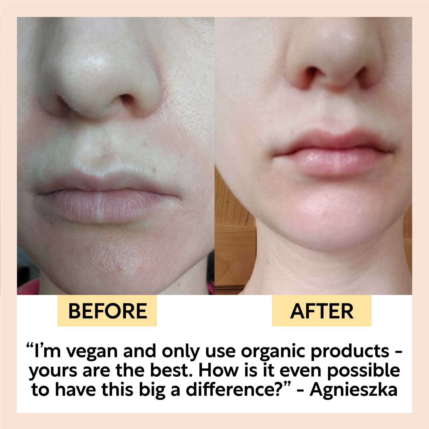 Hydration Skincare Set by UpCircle