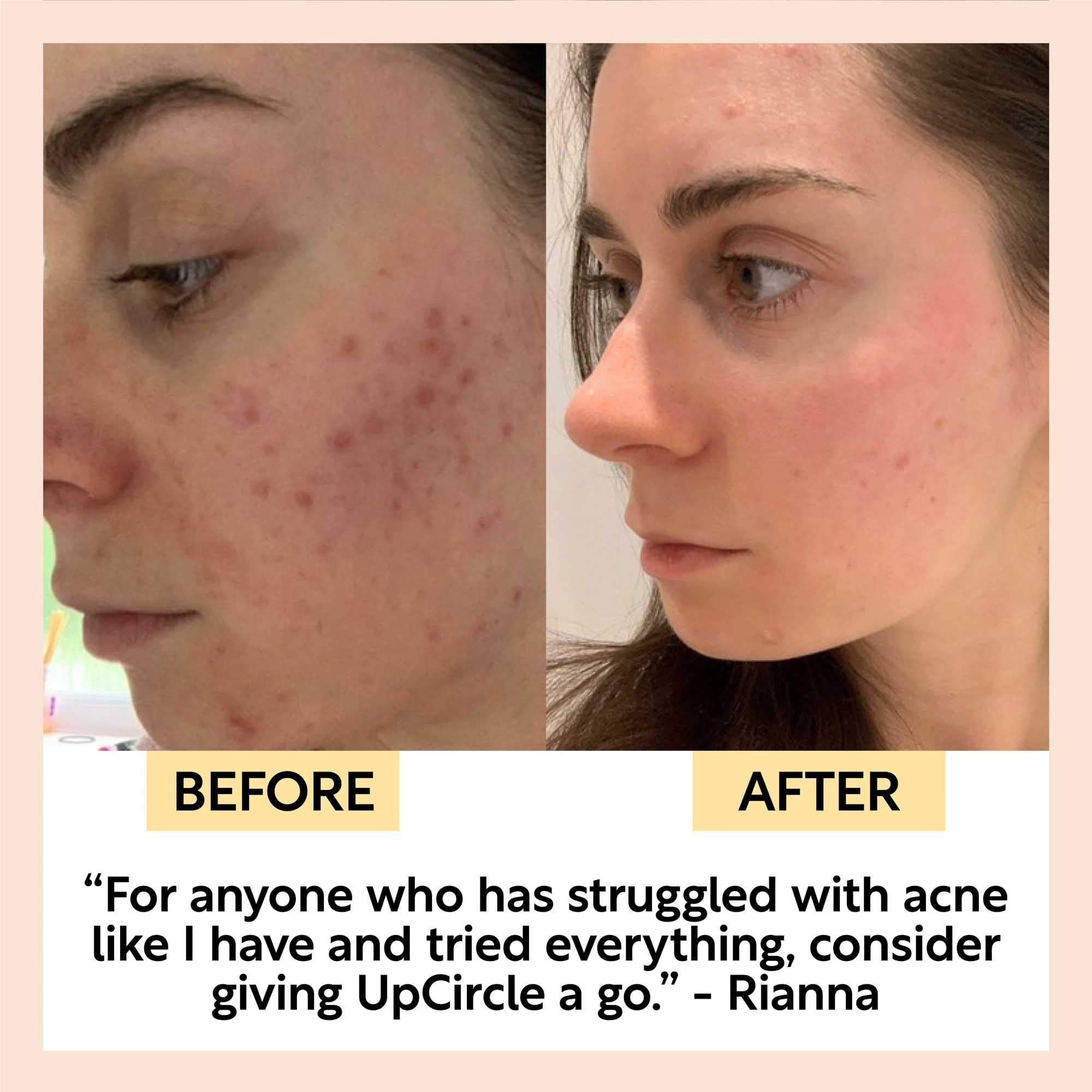 Cleanse, Tone + Moisturize Set by UpCircle