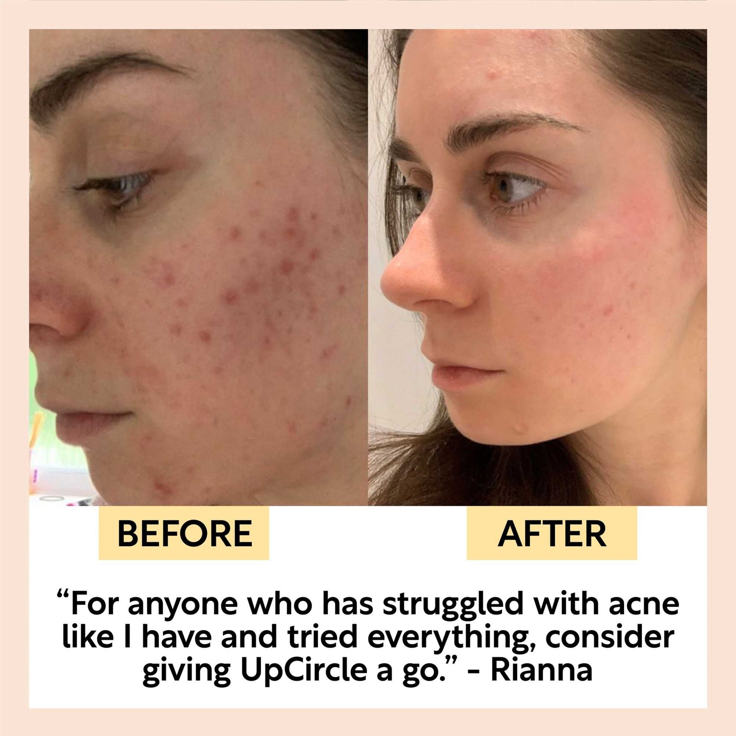 Face Toner with Hyaluronic Acid - Travel Size by UpCircle