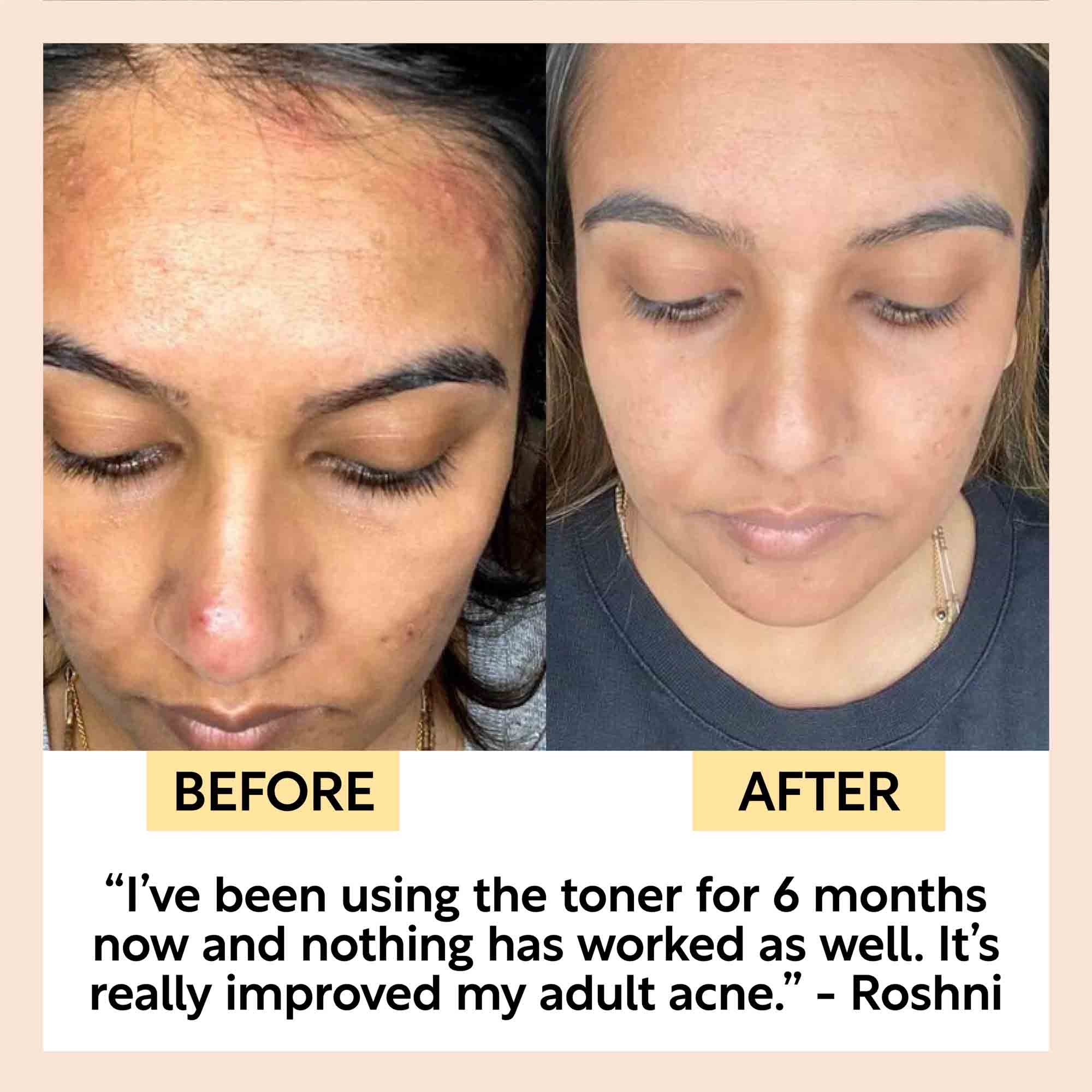 Face Toner with Hyaluronic Acid - Travel Size by UpCircle