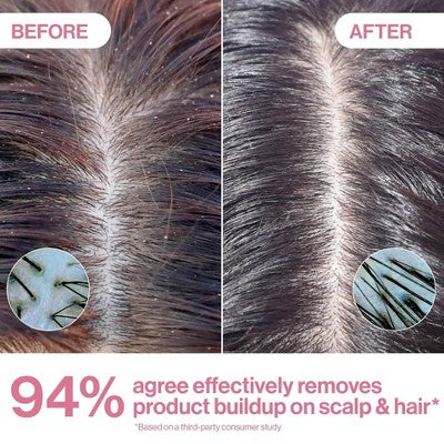 Rizos Curls Apple Cider Vinegar Scalp &amp; Hair Rinse 10 fl oz - Imperfect Container by This is Beauty US