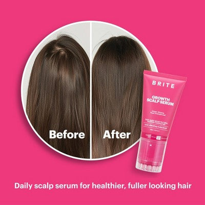 BRITE Growth Scalp Serum with Applicator 3.38 fl oz - Imperfect Box by This is Beauty US