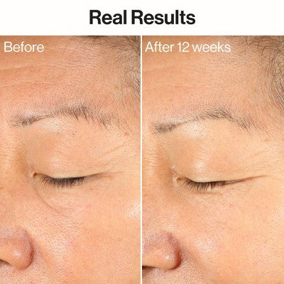 Honest Beauty Ageless Firm and Even Serum 1.0 fl oz - Imperfect Box by This is Beauty US