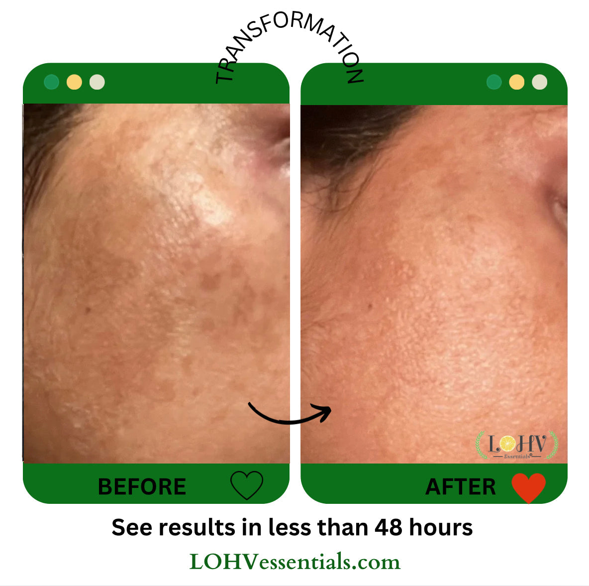 PREMIUM 100% VEGAN GLOW UP Toner Serum With Hyaluronic Acid + Niacinamide + Camellia Leaf + Vitamin E + Rose Water by LOHV ESSENTIALS