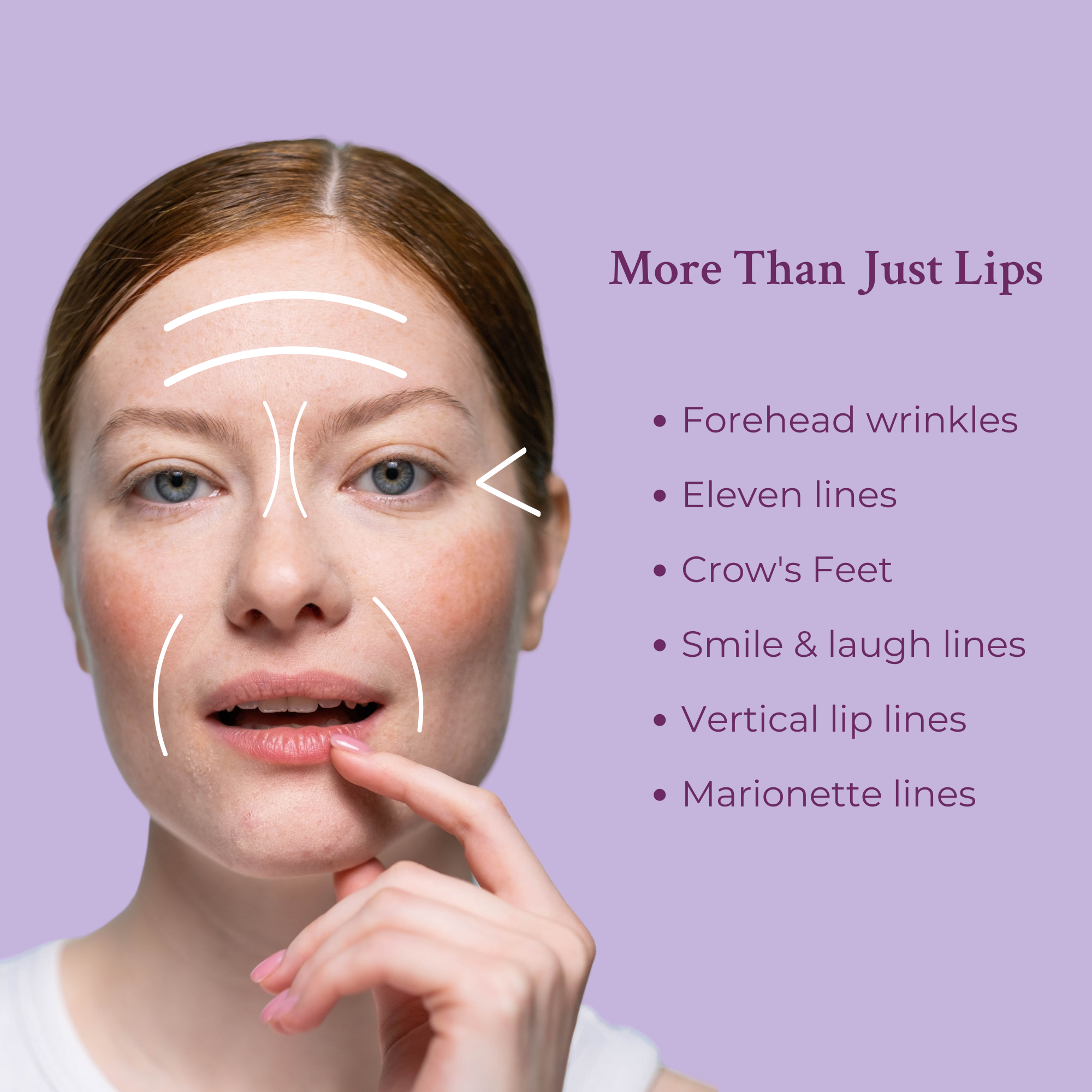 Ageless Lip &amp; Line Filler by PRAI Beauty
