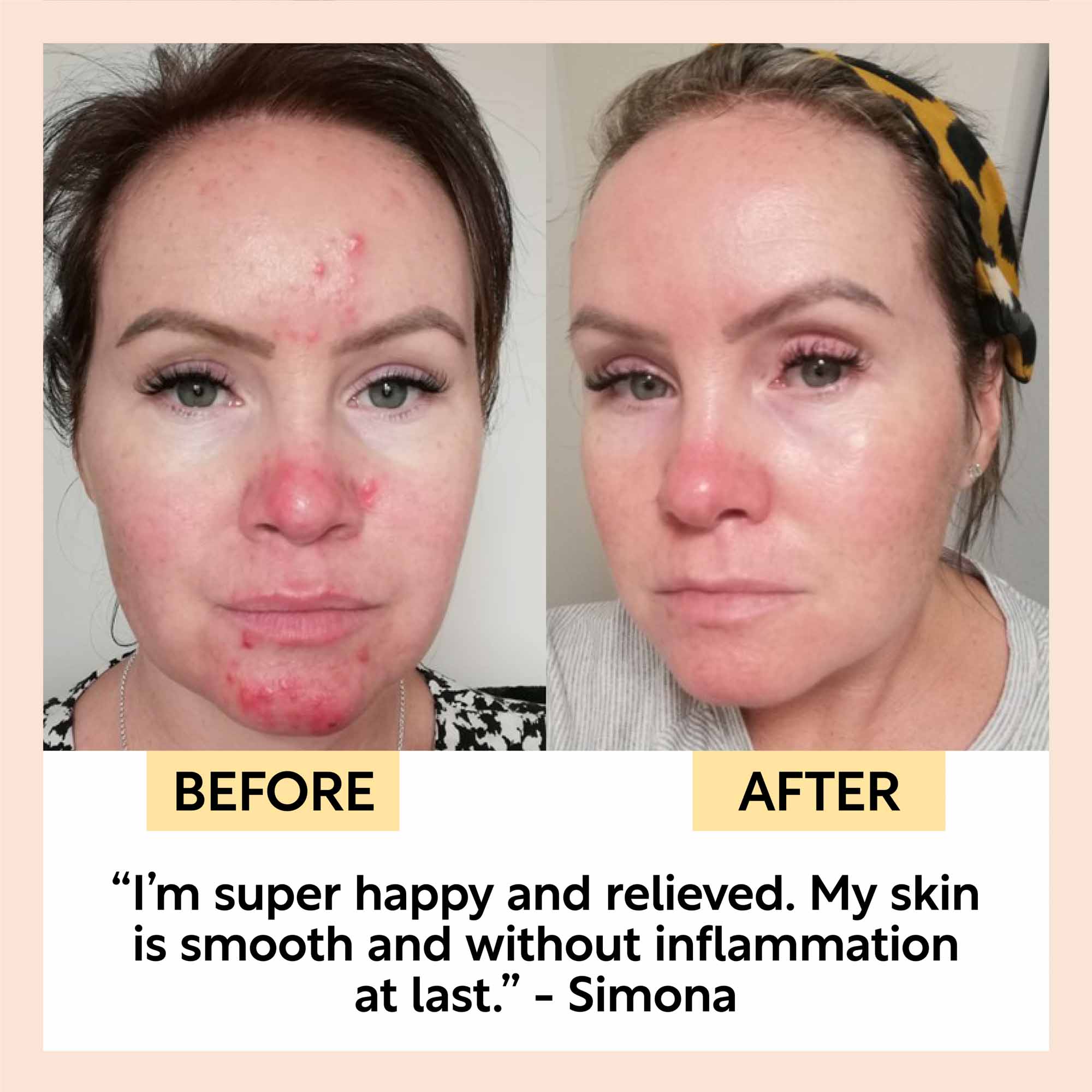 Day + Night Hydration Set by UpCircle