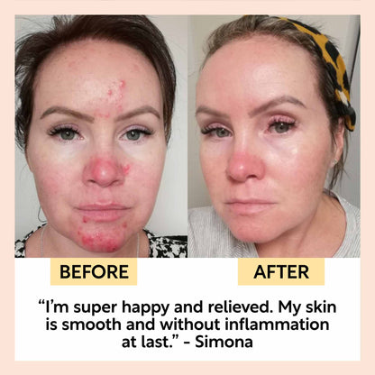 Night Cream with Hyaluronic Acid + Niacinamide by UpCircle
