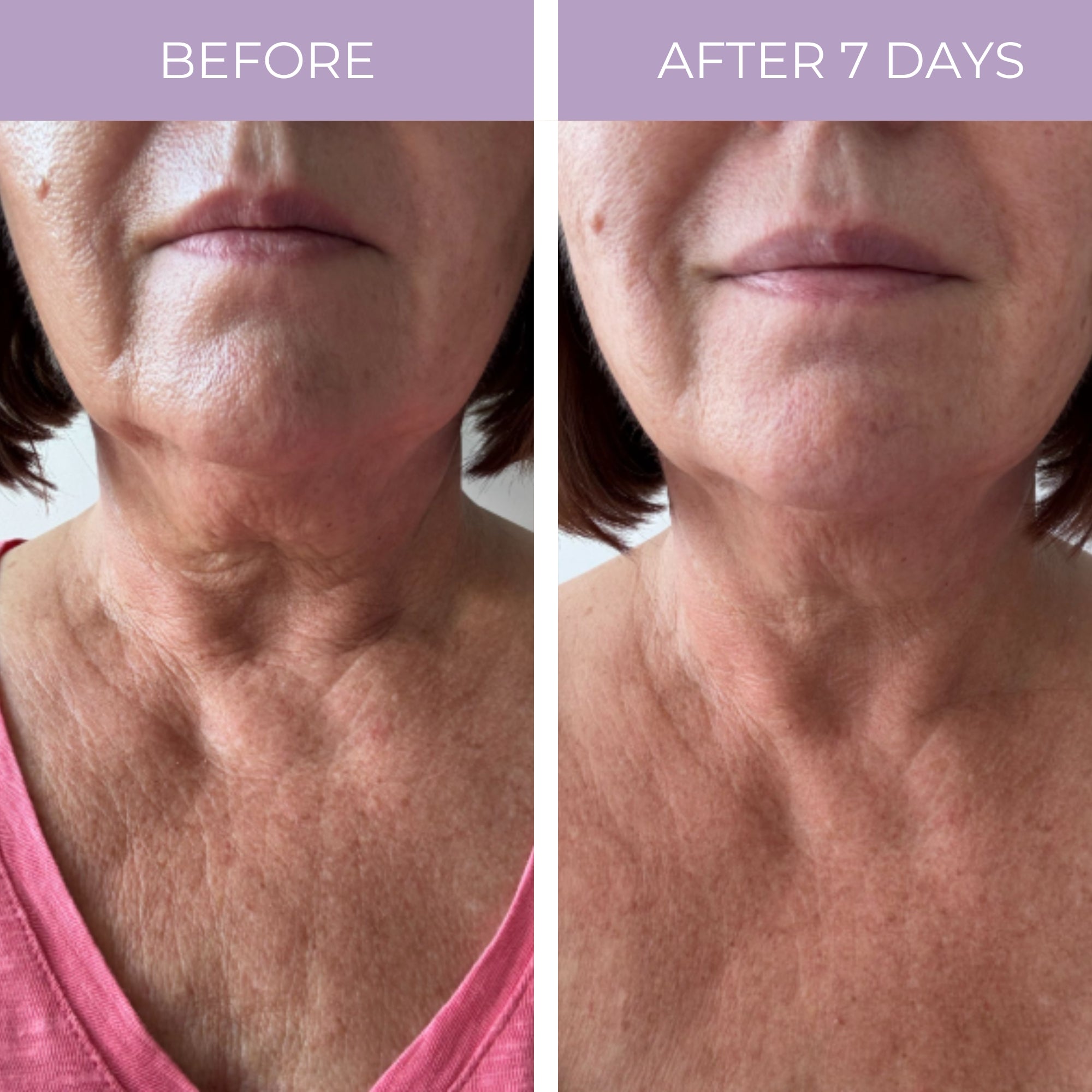 Ageless Throat &amp; Decolletage Anti-Aging Neck Creme by PRAI Beauty