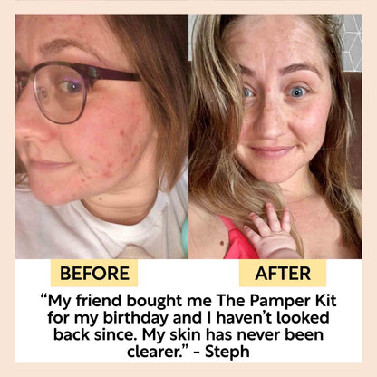 "Pamper + Gift" Skincare Kit by UpCircle
