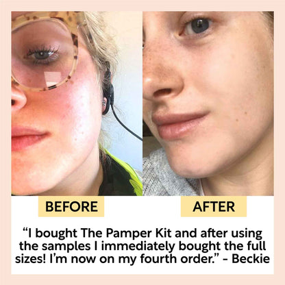 "Pamper + Gift" Skincare Kit by UpCircle