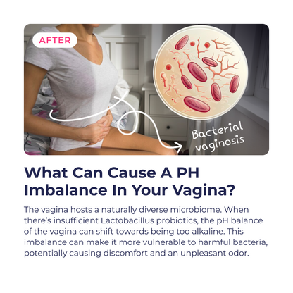 Feminine Flora for During &amp; After Menopause by RevitMe by RevitMe - Supplements Store