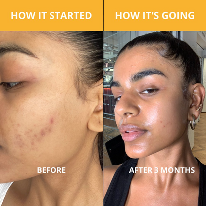 Turmeric Kojic Acid Soap - Face and Body by TUMERI