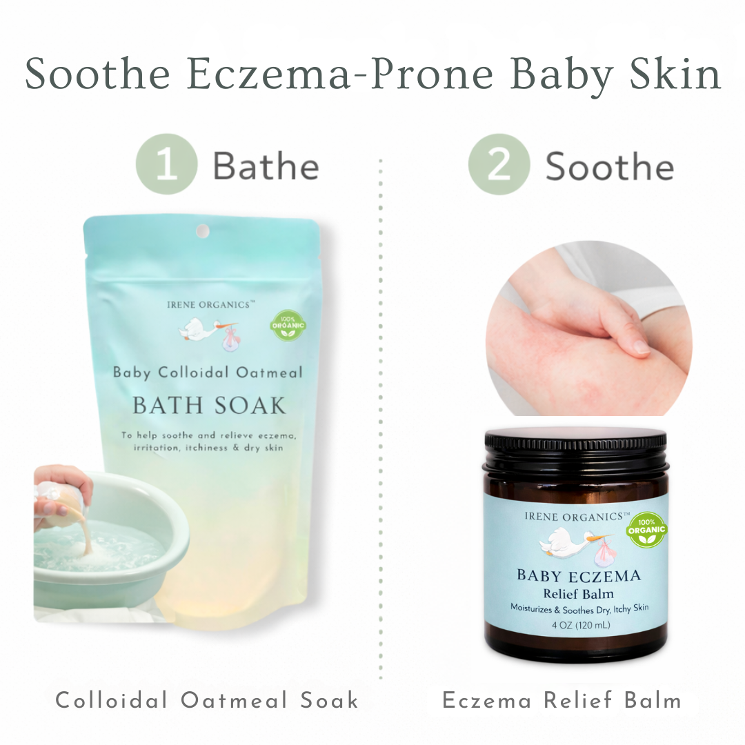 Eczema Baby Skincare Duo by Irene Organics